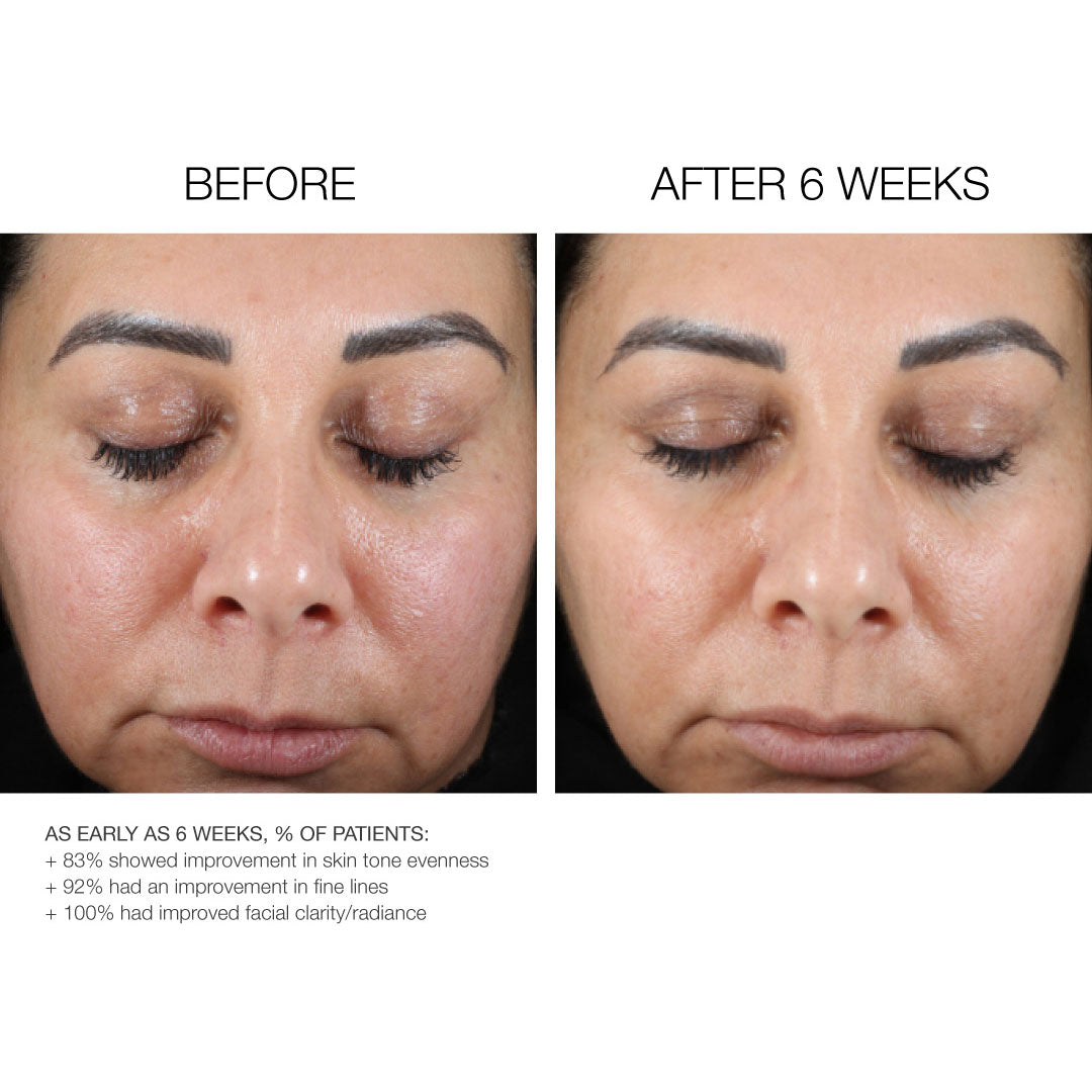 Refine + Renew Retinol 10 Gelée Serum