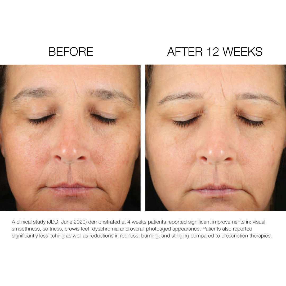Retinoin PM Treatment Serum 5X