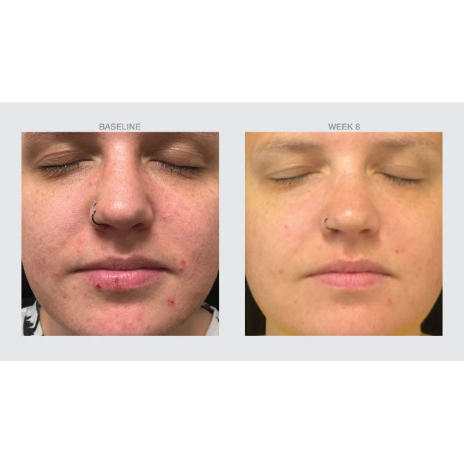 Équilibre Oil Control Serum