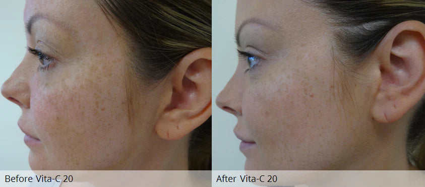 Radiant Glow + 20% Vitamin C Crème