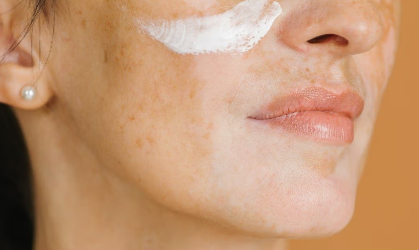 Kojic Acid: A Natural Brightener That Works