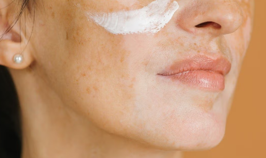 Kojic Acid: A Natural Brightener That Works
