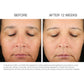 Retinoin PM Treatment Serum 5X