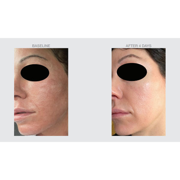 Concentrated Antioxidant Barrier Repair Serum