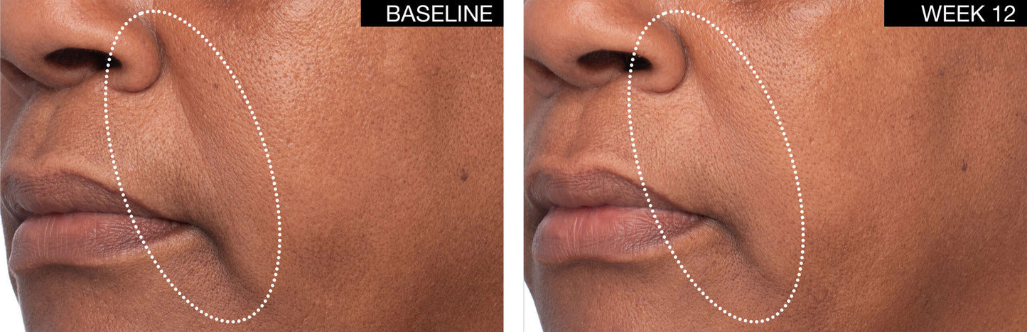 Crème Replénissante Lift & Volume Restore