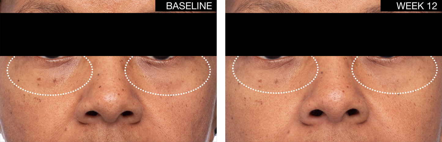 Crème Replénissante Lift & Volume Restore