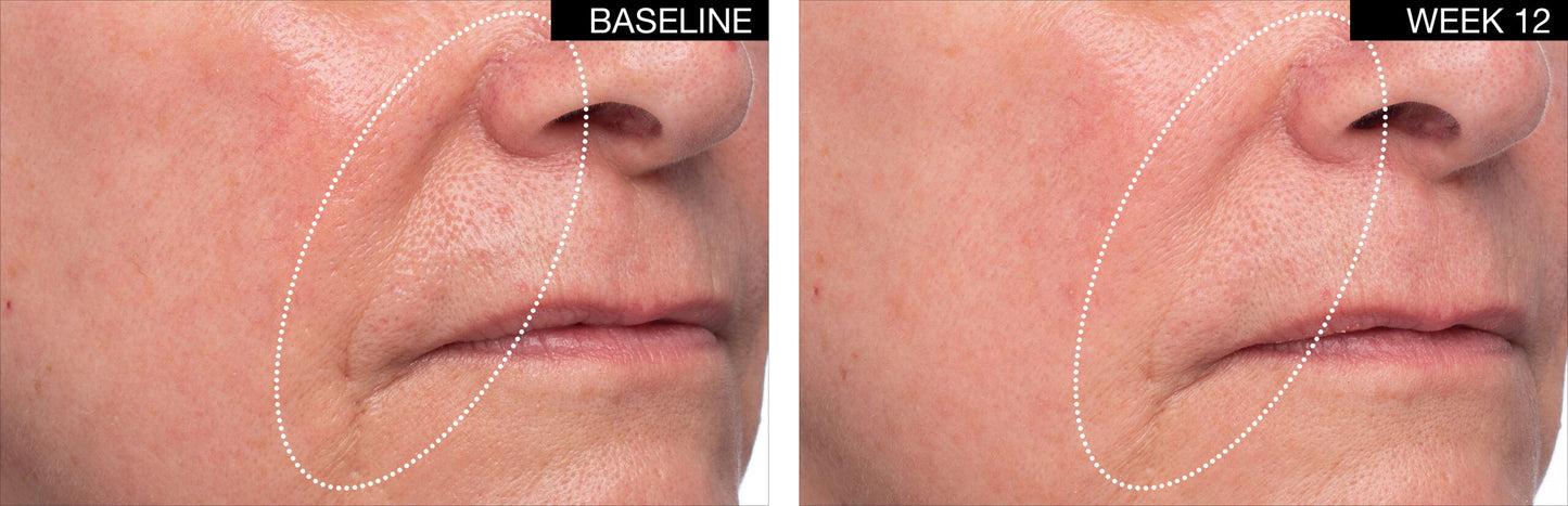 Crème Replénissante Lift & Volume Restore