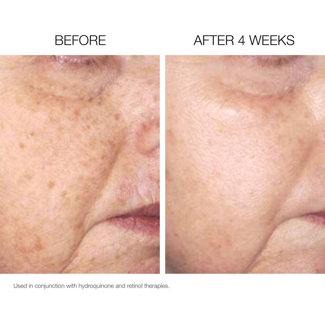 Clinical Brightening Set