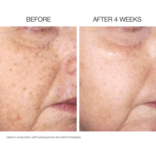 Clinical Brightening Set