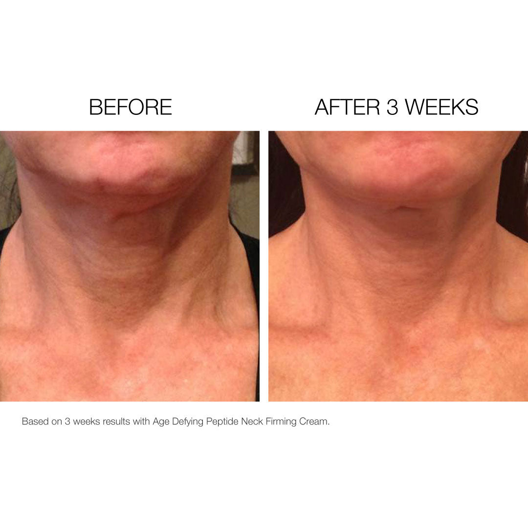 Neck + Décolletage Firming Crème
