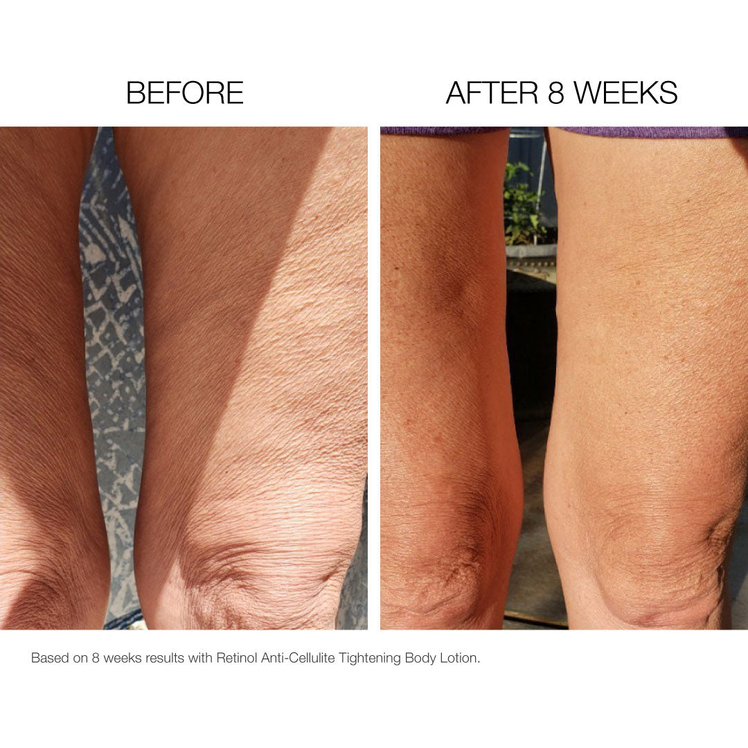 Ceramide Complex Cellulite Control + Retinol Body Crème