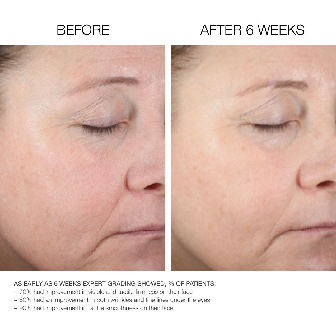 Ultra Hydrating Hyaluronic Acid Serum