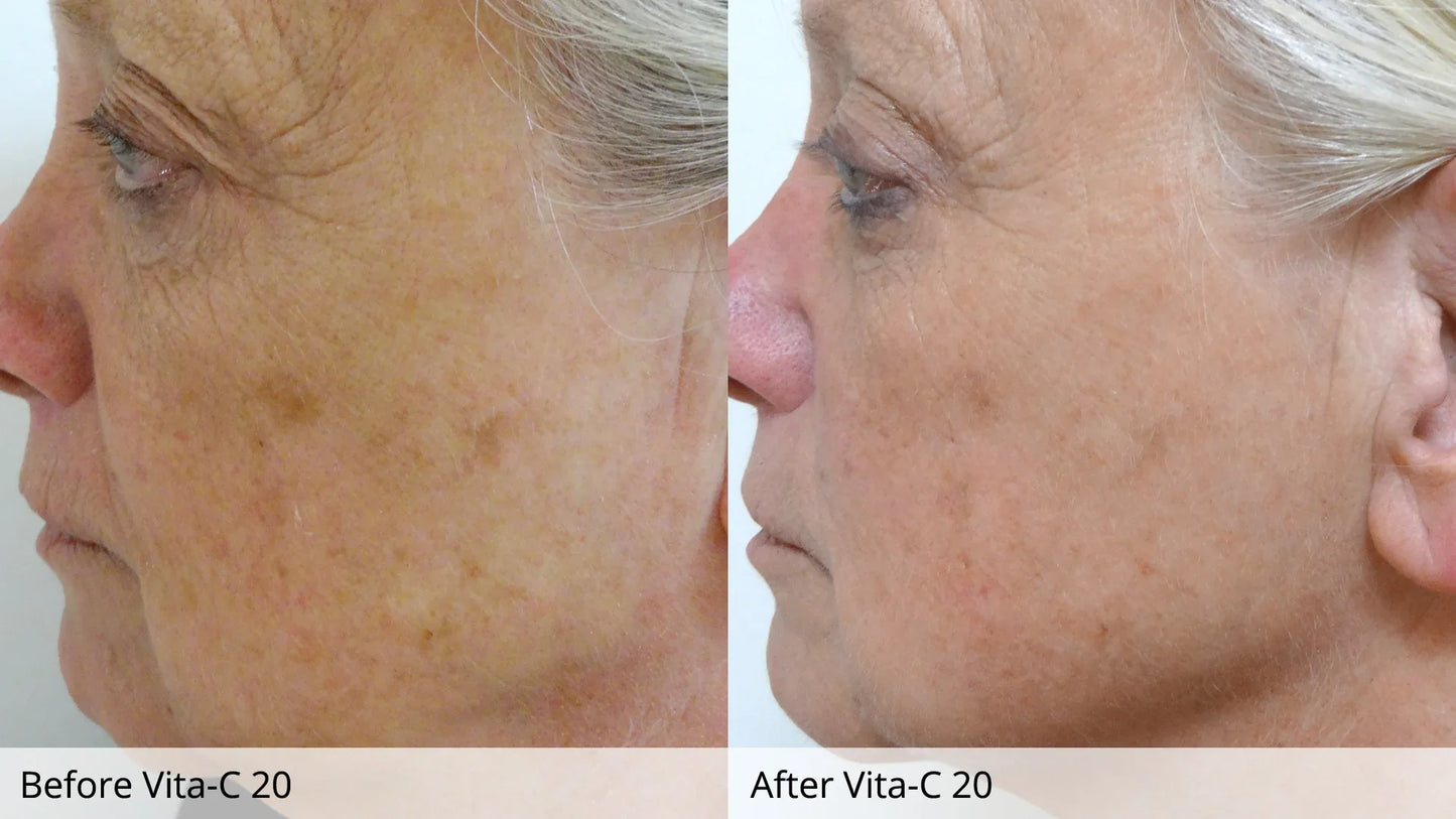 Radiant Glow + 20% Vitamin C Crème